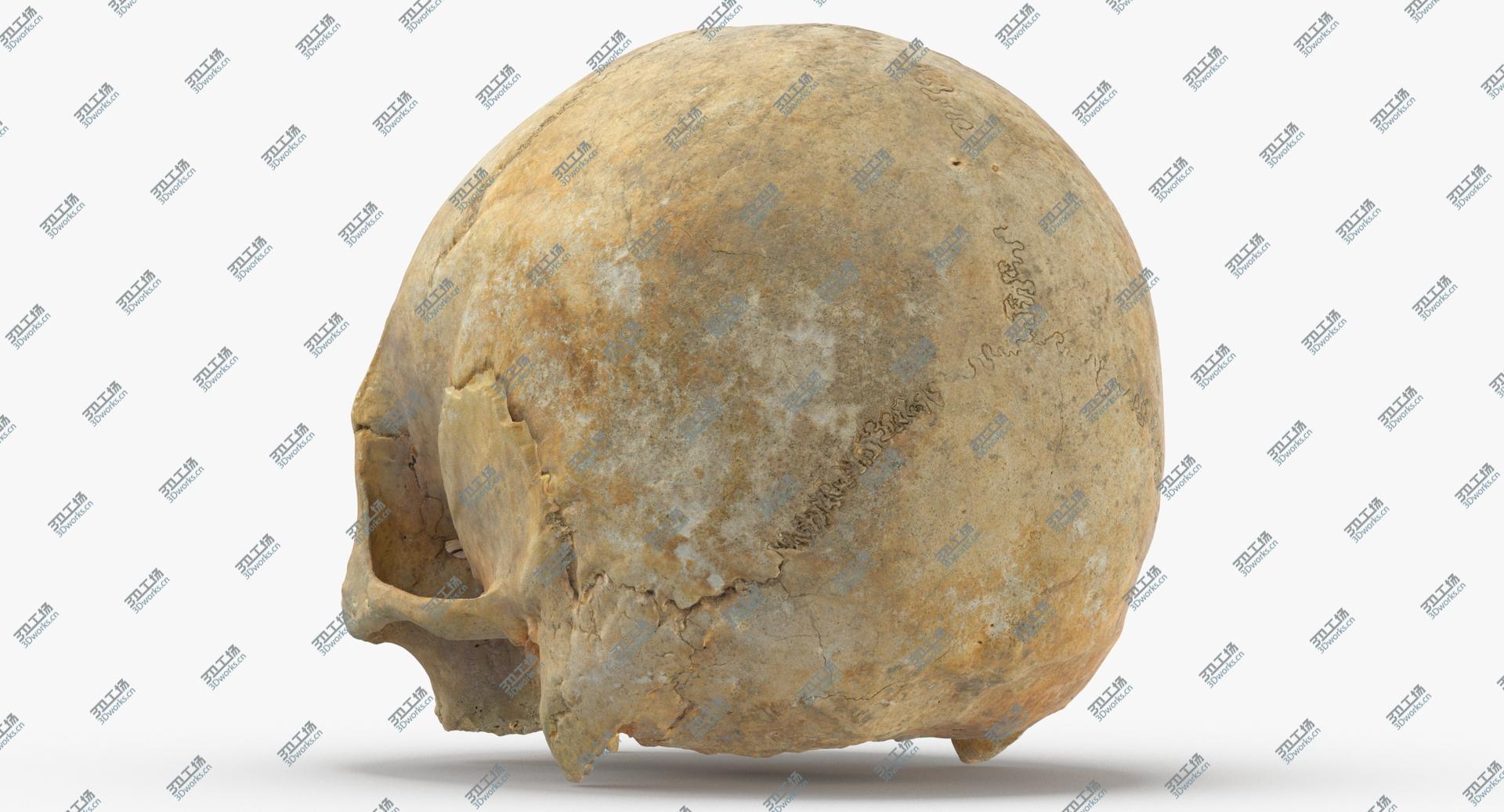 images/goods_img/202104023/Real Human Skull Cranium with Leprosy 01 3D model/5.jpg